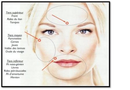 Chirurgie esthétique facial rajeunir remodeler votre visage